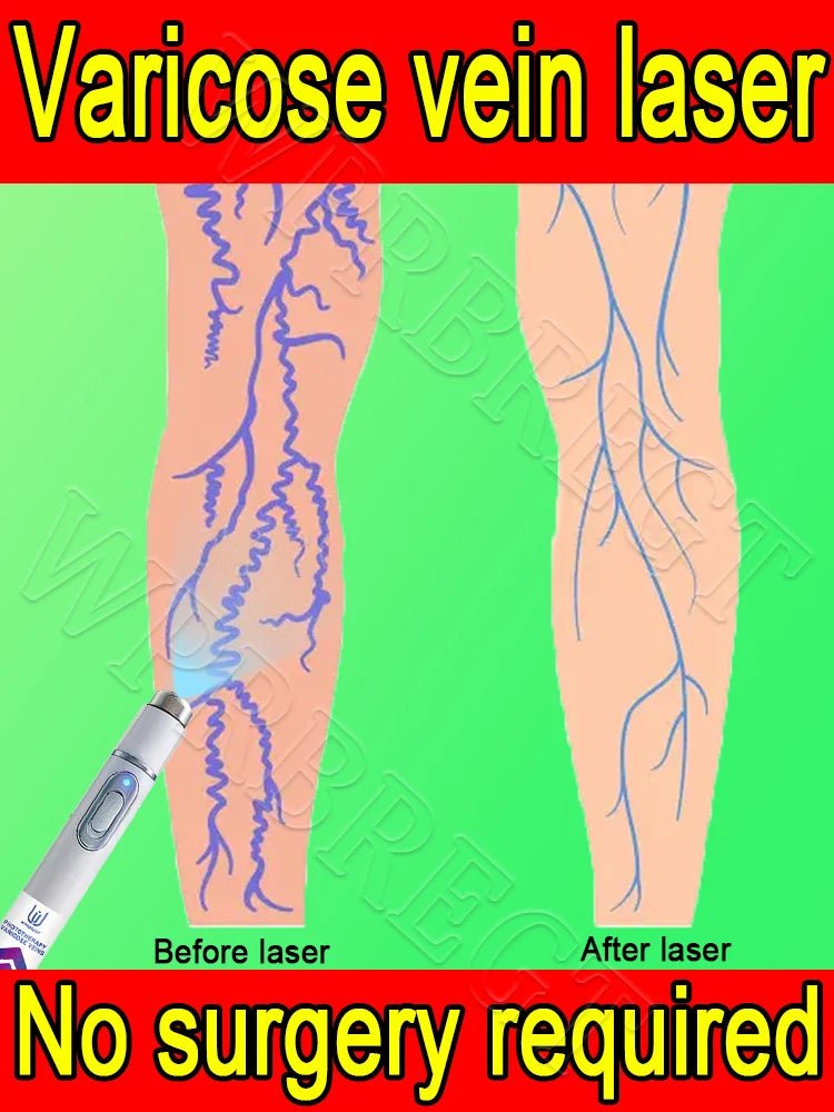 External red light wellness device applied to legs for cosmetic skin appearance support