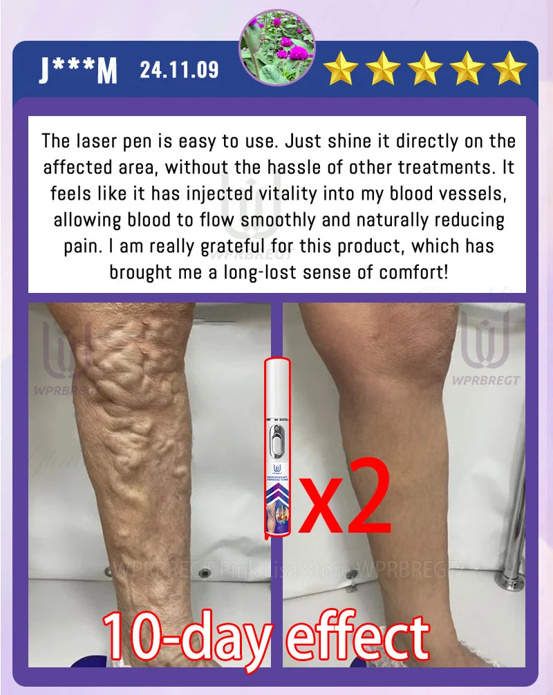 Generation 2 Intravenous Laser Therapy Device – Red Light for Circulation & Cellular Regeneration - Zack Fitness