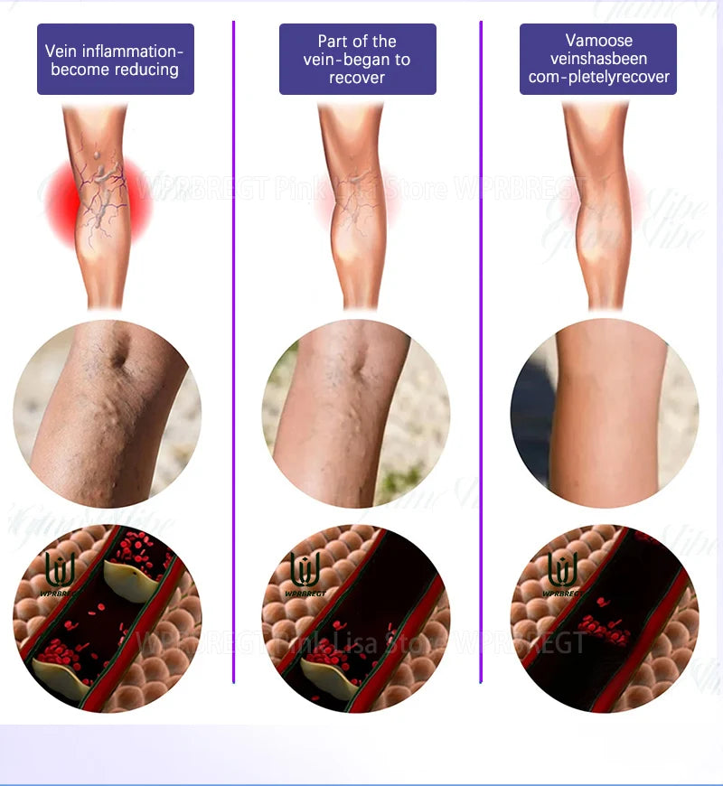 Generation 2 Intravenous Laser Therapy Device – Red Light for Circulation & Cellular Regeneration - Zack Fitness
