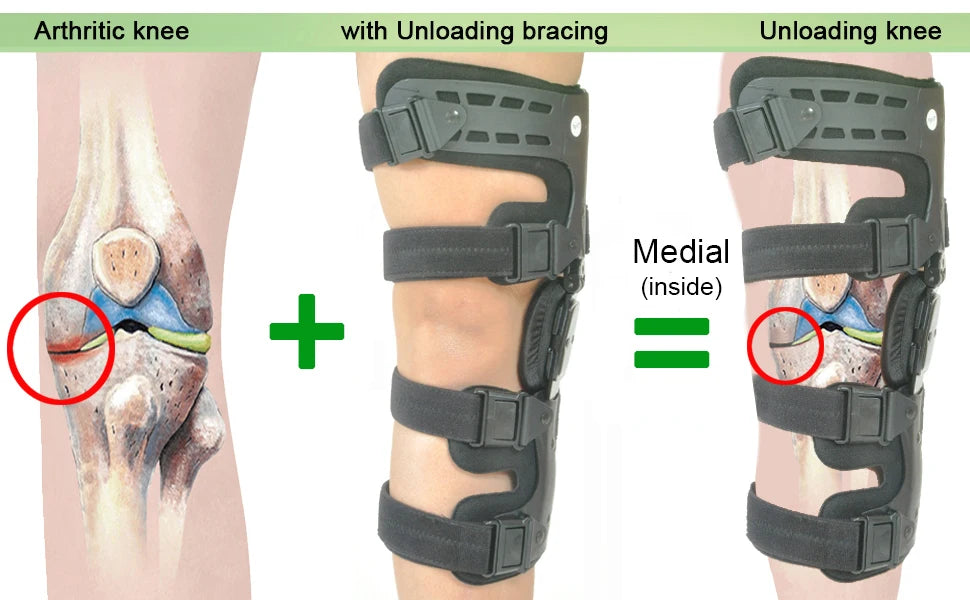 OA Knee Brace for Arthritis | Pain Relief & Joint Stability Support - Zack Fitness