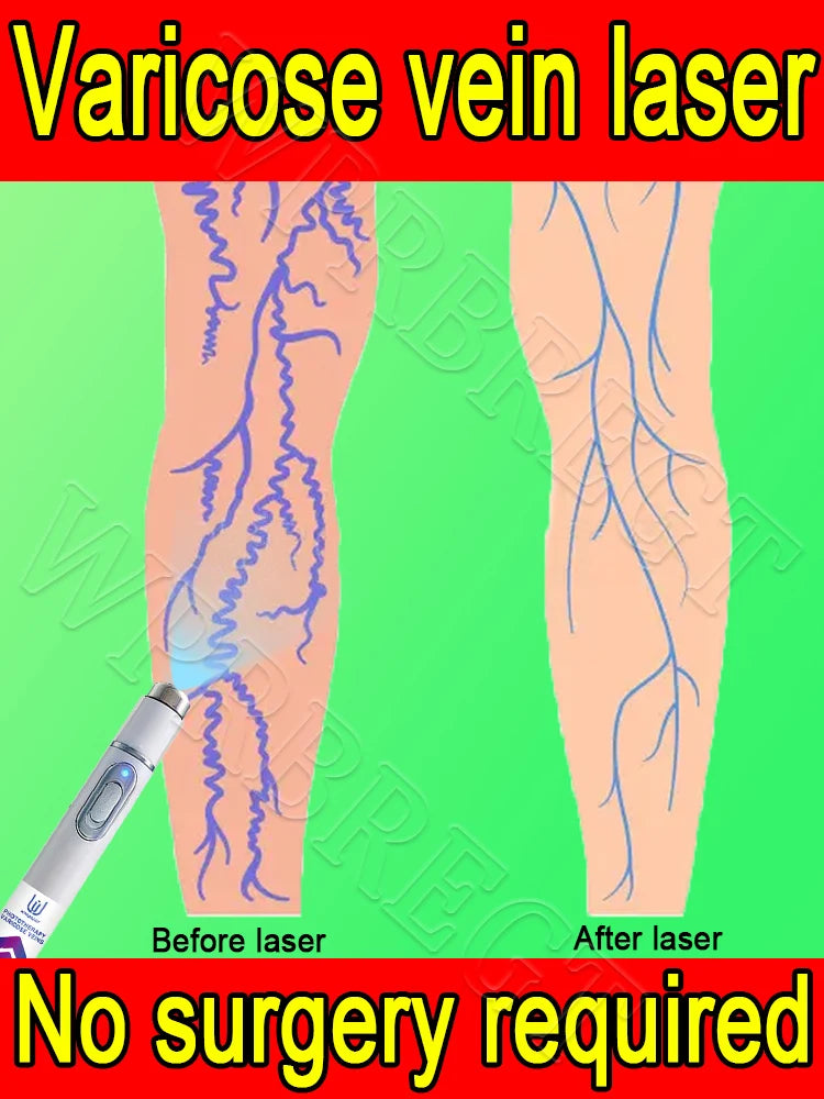 Generation 2 Intravenous Laser Therapy Device – Red Light for Circulation & Cellular Regeneration - Zack Fitness