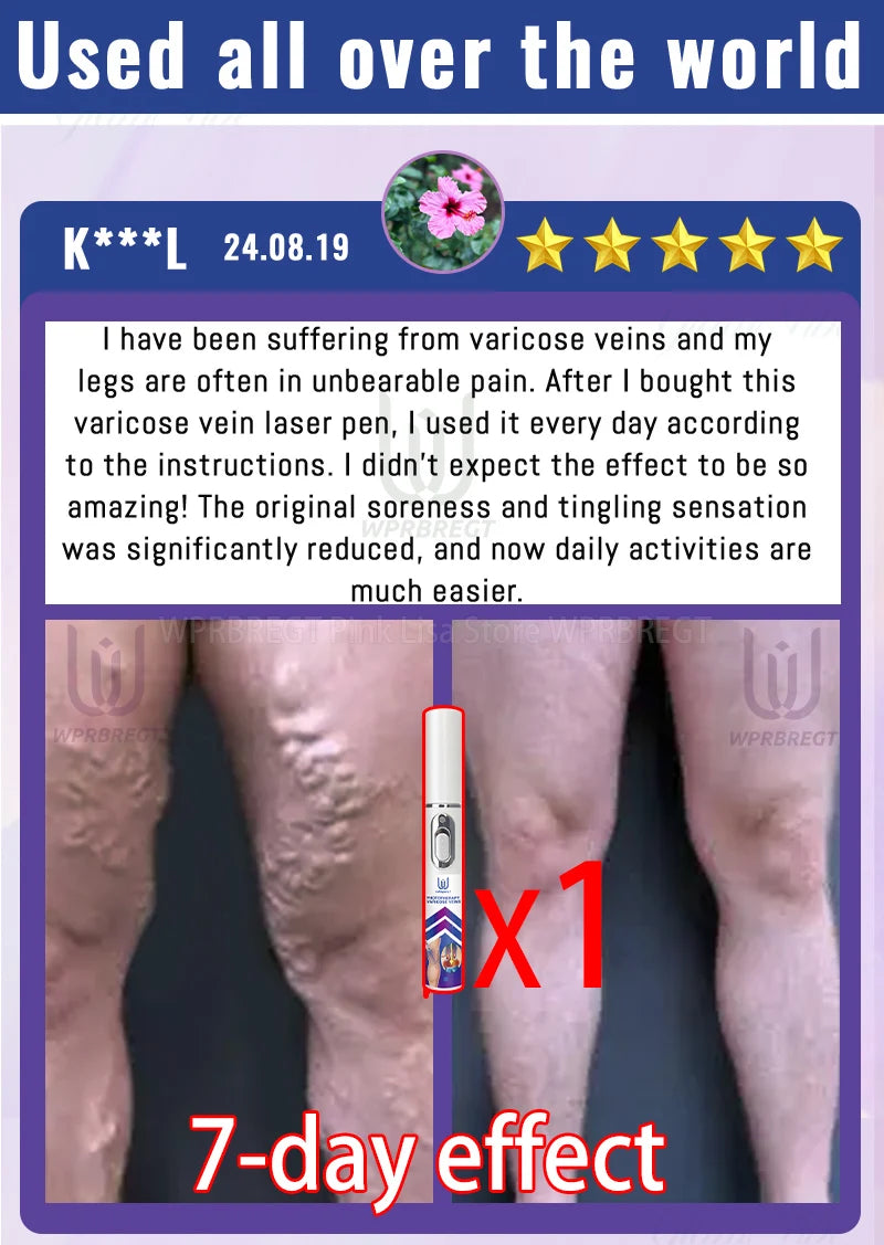 Generation 2 Intravenous Laser Therapy Device – Red Light for Circulation & Cellular Regeneration - Zack Fitness