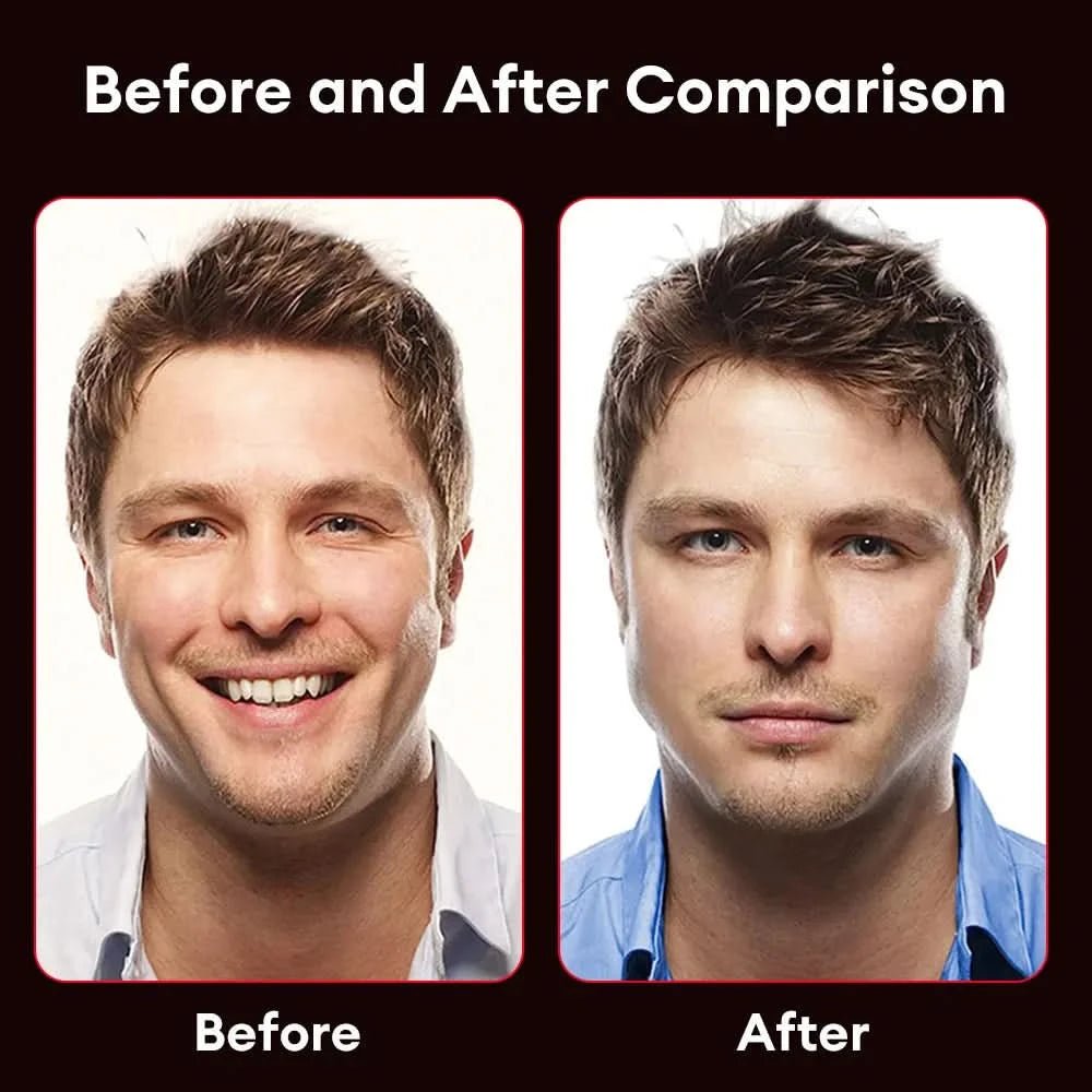 Zack Jawline Exerciser Ball - Zack Fitness