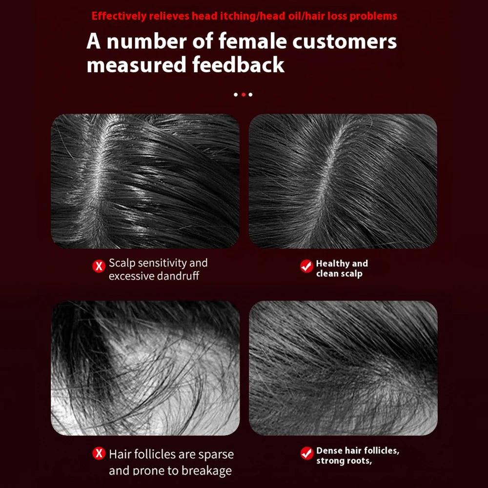 hair follicle activation comb with red light therapy