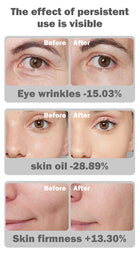 Red light therapy mask designed to fit face shape for even red light therapy coverage at home