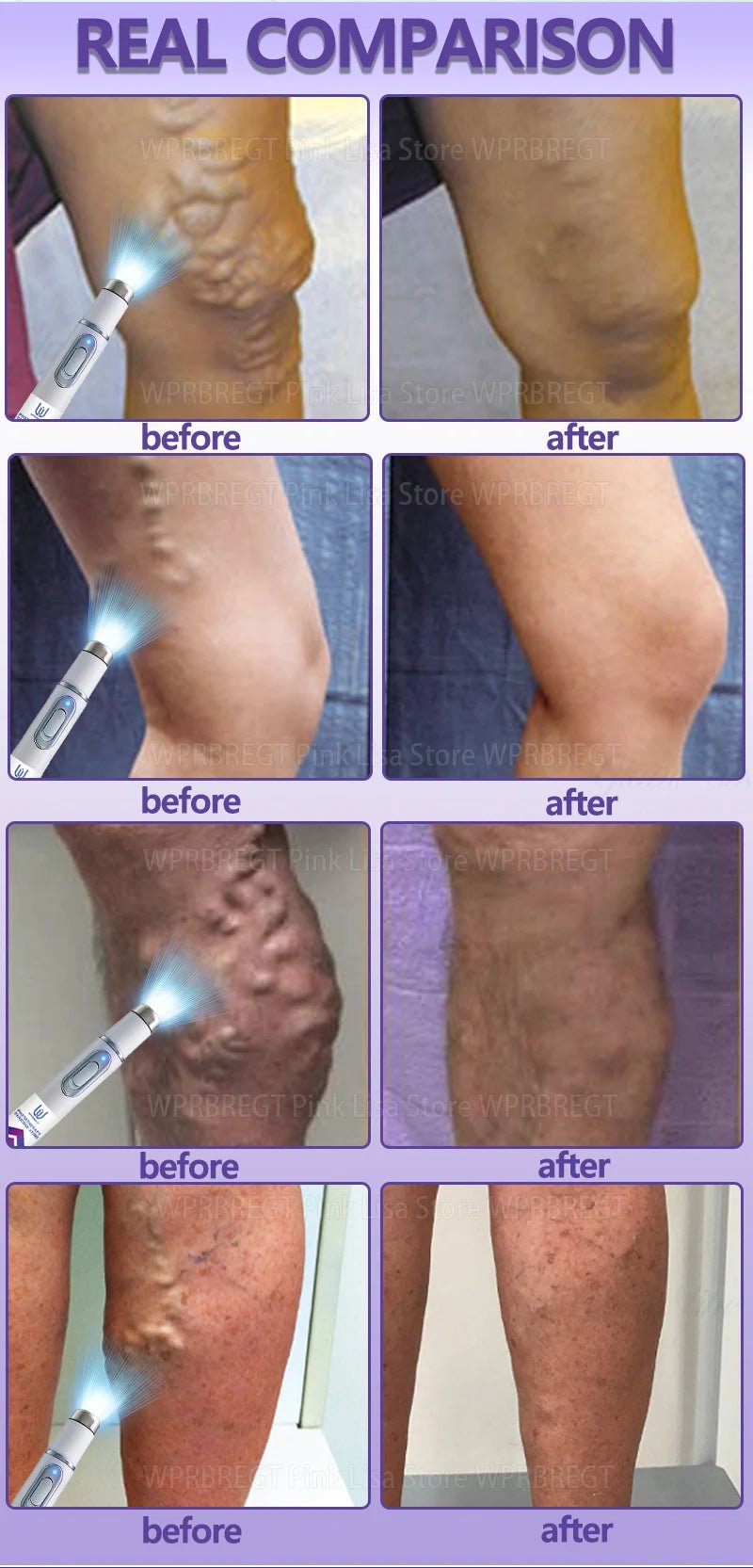 External red light device integrated into relaxation and self-care routines
