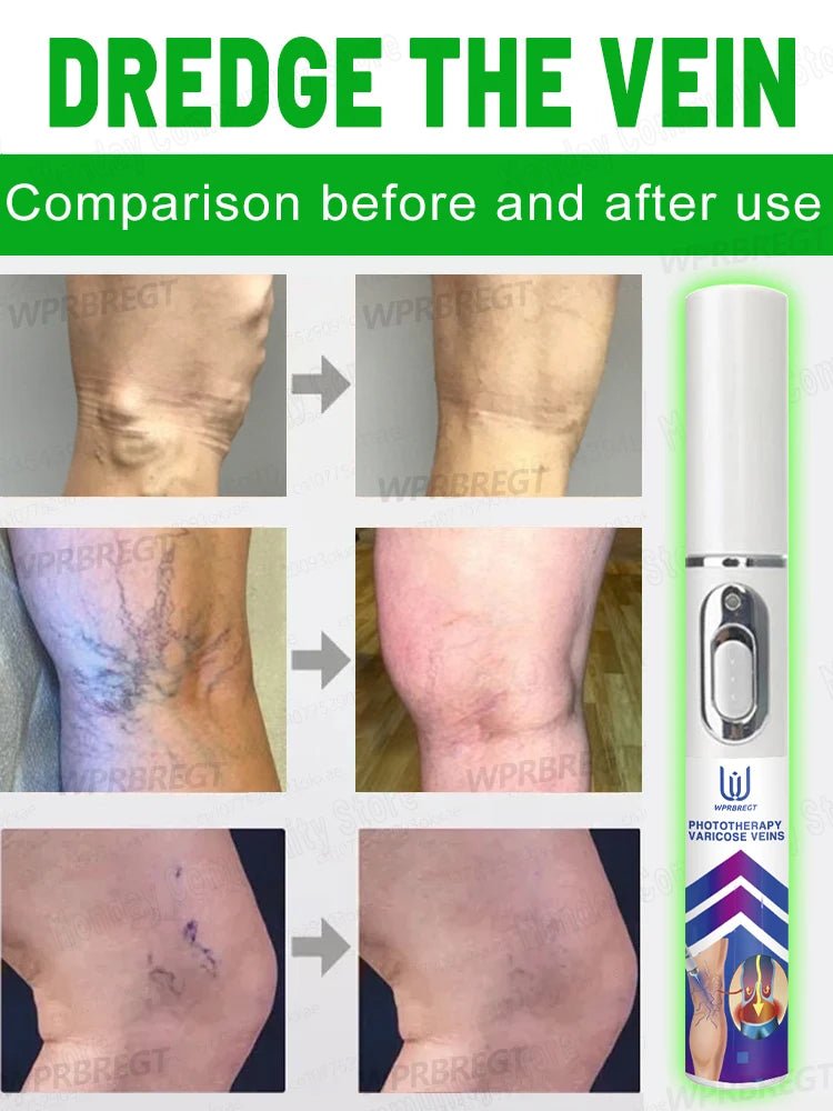 Red light wellness device used externally to support everyday leg comfort