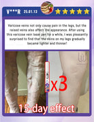 Generation 2 Intravenous Laser Therapy Device – Red Light for Circulation & Cellular Regeneration - Zack Fitness