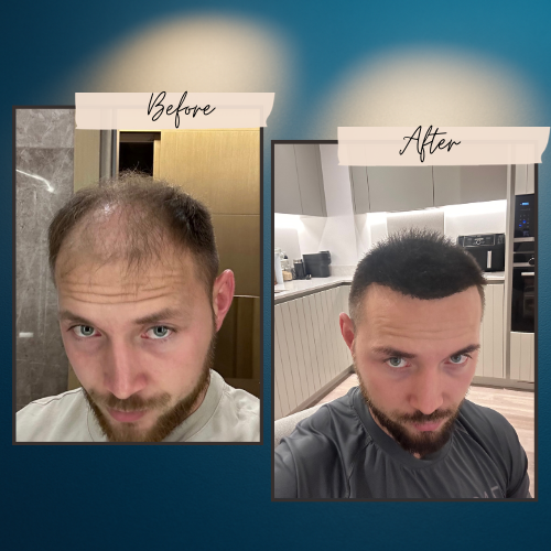 Everyday Wearable Therapy Cap