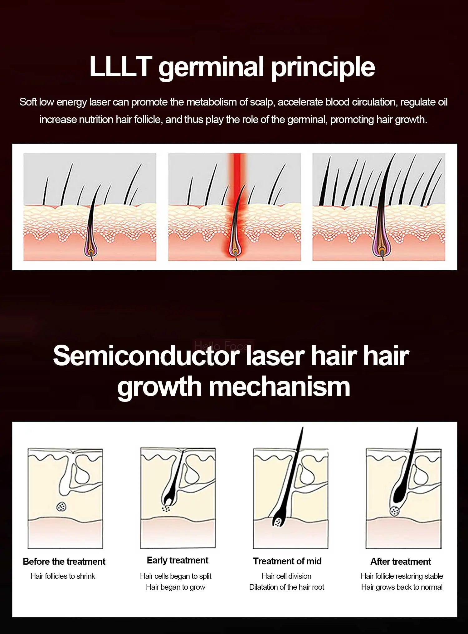 professional hair growth laser cap for consistent scalp treatment