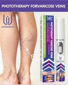 Phototherapy device using red light for skin and leg wellness support, external application