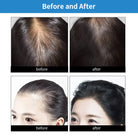 Red Light & Infrared Therapy Cap – 660nm & 830nm LED Hair Growth Helmet | Anti Hair Loss & Scalp Relaxation - Zack Fitness