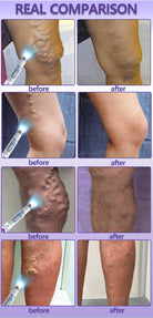 Red light therapy device supporting cosmetic skin appearance and leg comfort, external use only