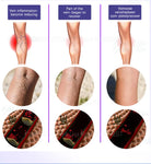 Key advantages of red light therapy including non-invasive design and beginner-friendly use